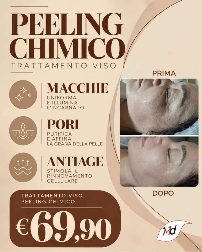 peeling chimico